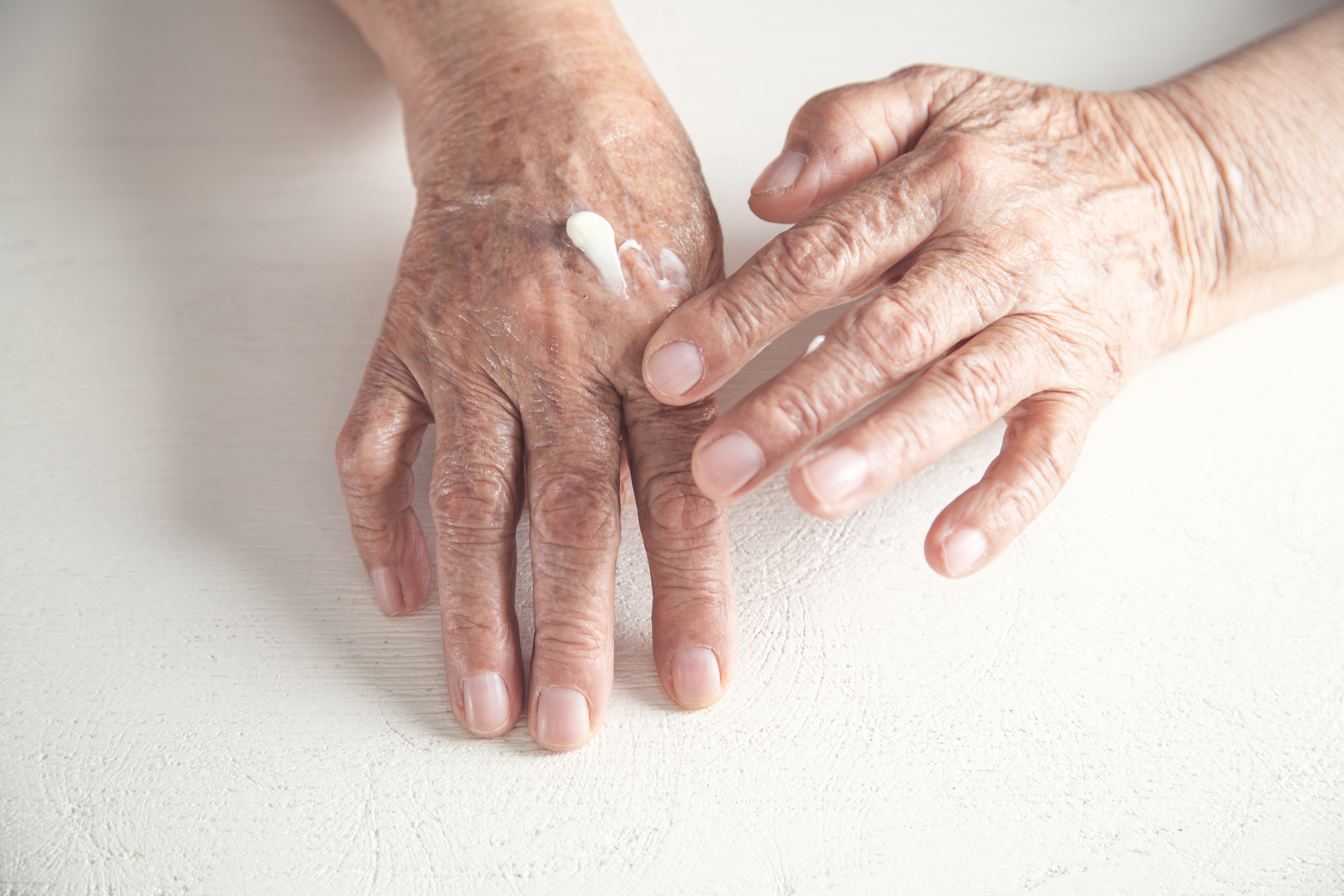 Barrier Creams for Elderly Parents - dignified image of cream being patch tested on hand